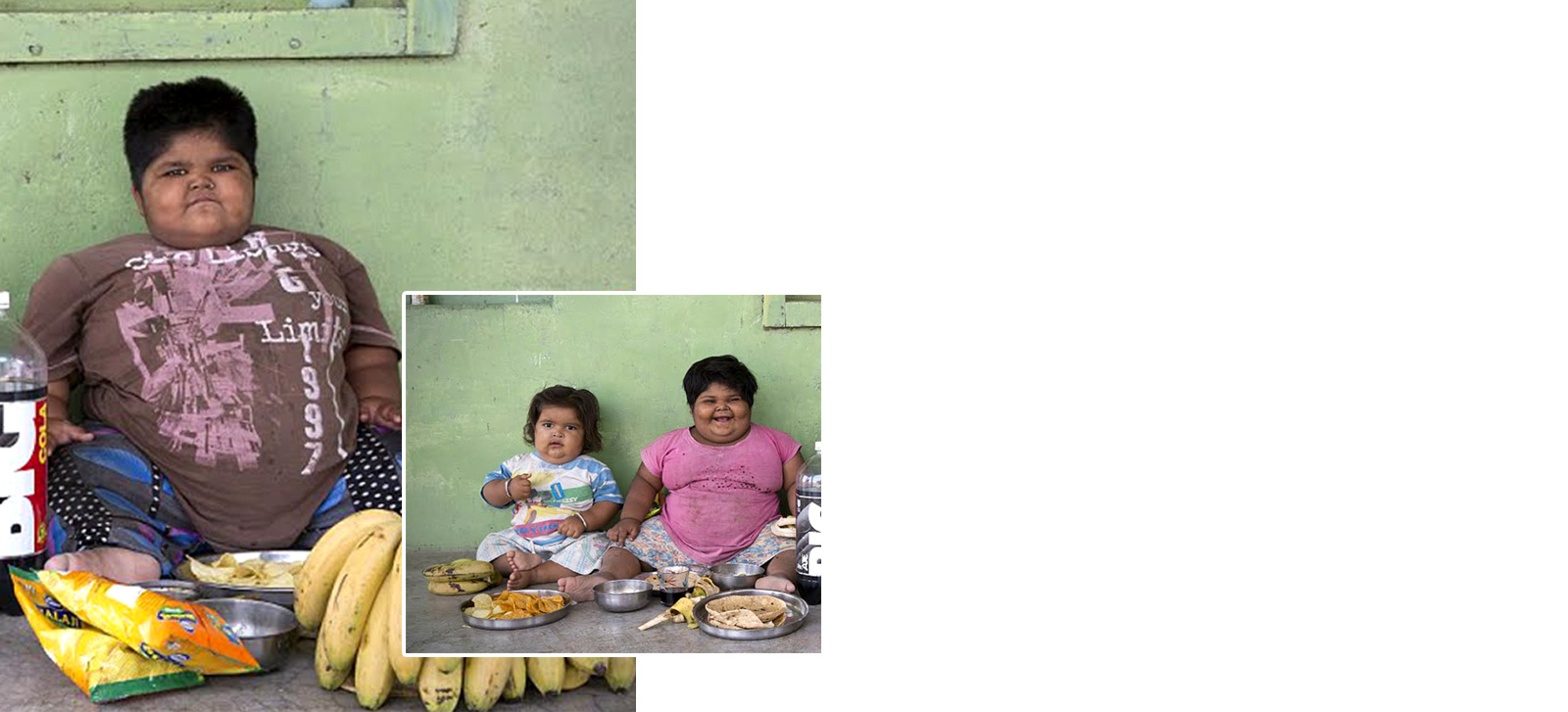 Obesity3